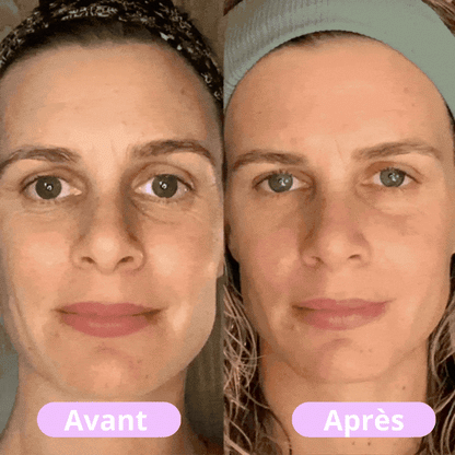 Blomana - Masseur facial LED tonifiant